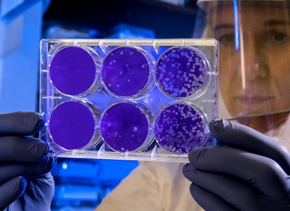 Mass cultivation of stem cells