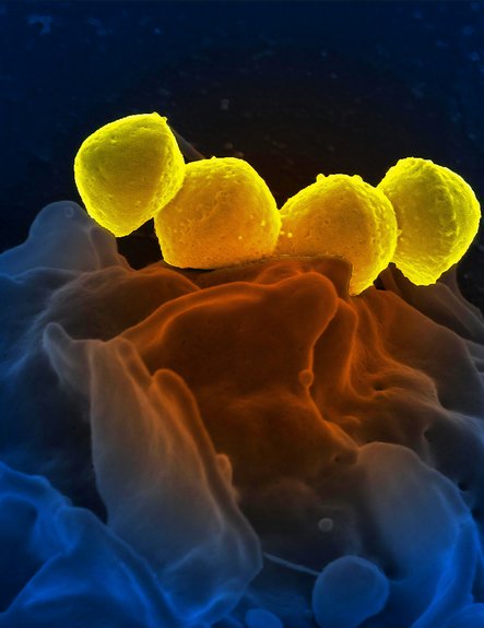 Microbiome