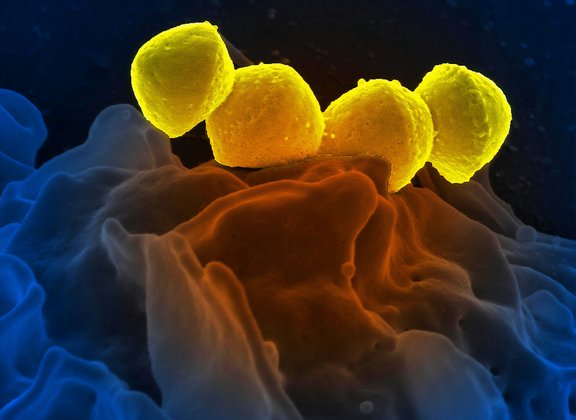 Microbiome